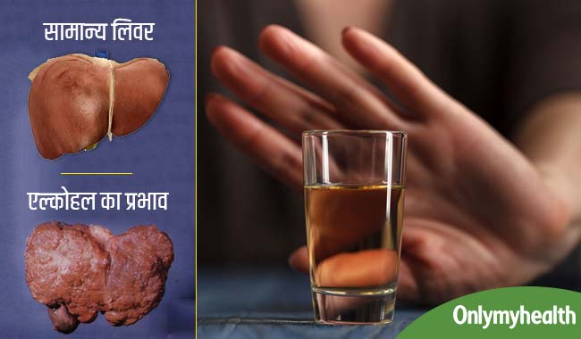एल्कोहल के ज्यादा सेवन से सिरोसिस ही नहीं, होता है इन 5 बीमारियों का खतरा